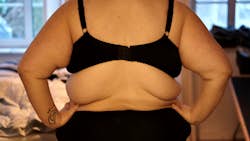 Nadjas farvel til de 170 kilo
